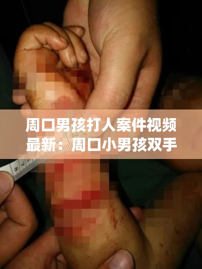 周口男孩打人案件视频最新：周口小男孩双手被砍断事件 